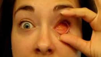 Enucleation - Eyes Alive